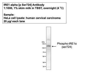 Western Blot Detection of IRE1 alpha in HeLa Cell Lysate